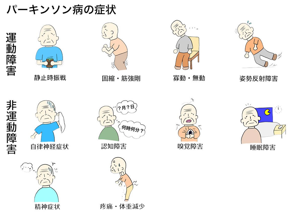 パーキンソン病イメージ